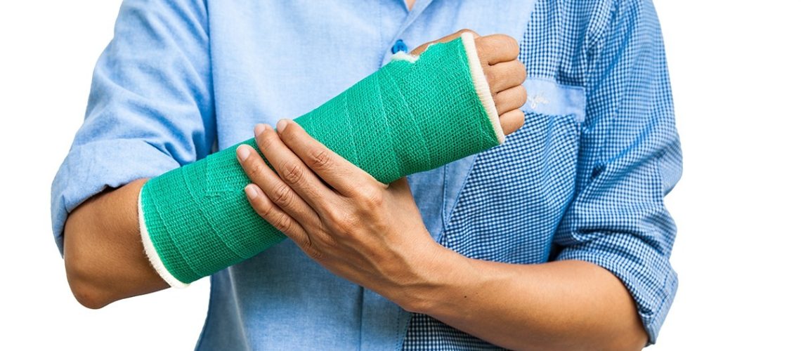 Green cast on an arm of a women isolated on white background