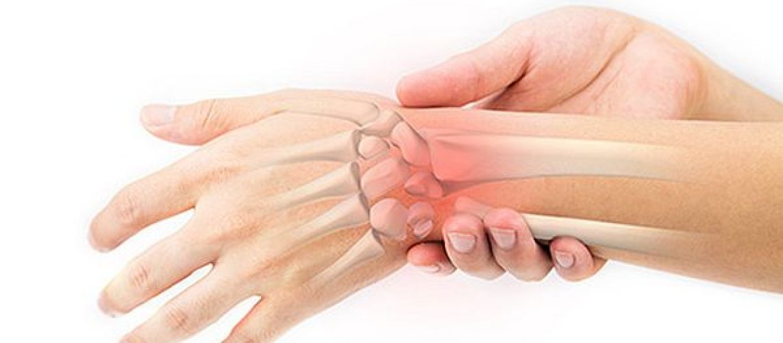 Wrist-supports-sprained-wrist