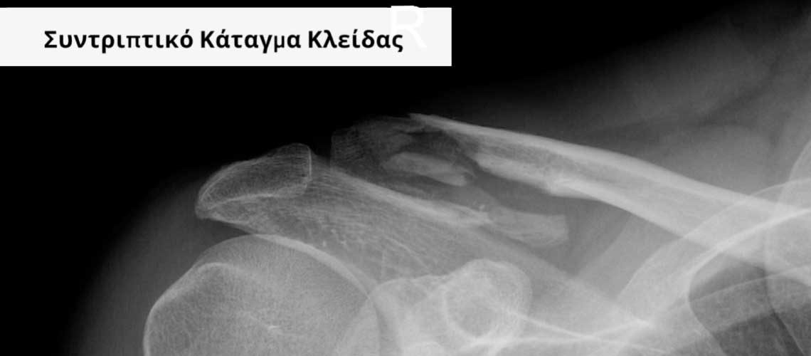 venouziou-articles-case-katagma-kleidas